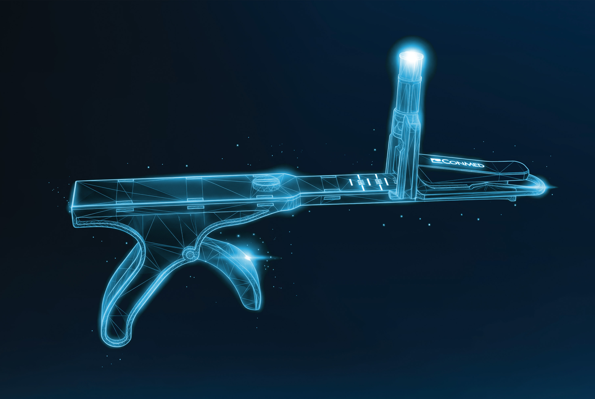 Illustration of a full-thickness quadriceps tendon harvest